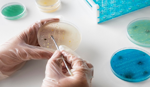 Controle da Listeria monocytogenes em POA